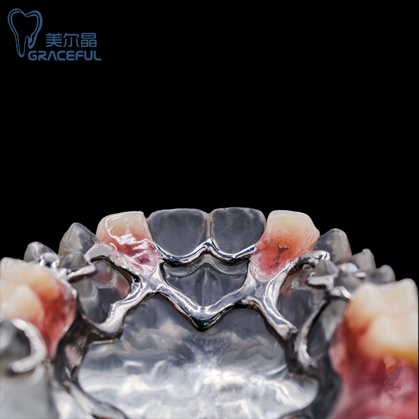 Estructura metàl·lica dental (2)