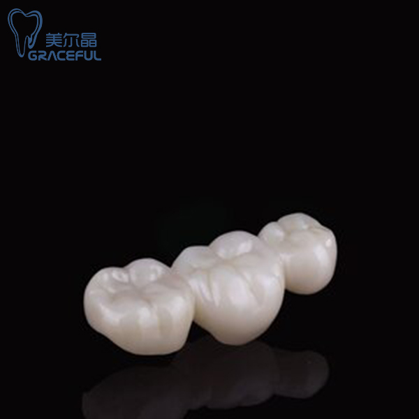 Vương miện Zirconia (2)